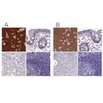 SNAP91 Antibody in Immunohistochemistry (IHC)