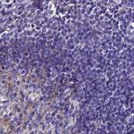 SNAP91 Antibody in Immunohistochemistry (IHC)