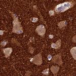 SNAP91 Antibody in Immunohistochemistry (IHC)