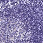 SNAP91 Antibody in Immunohistochemistry (IHC)