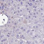 SNAP91 Antibody in Immunohistochemistry (IHC)