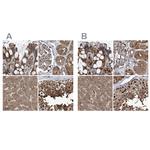 PSMB1 Antibody in Immunohistochemistry (IHC)