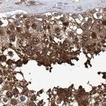 PSMB1 Antibody in Immunohistochemistry (IHC)