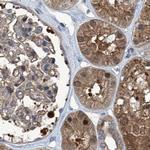 PSMB1 Antibody in Immunohistochemistry (IHC)