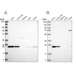 PSMB1 Antibody in Western Blot (WB)