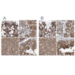 PSMB1 Antibody in Immunohistochemistry (IHC)