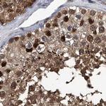 PSMB1 Antibody in Immunohistochemistry (IHC)