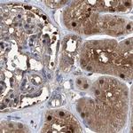 PSMB1 Antibody in Immunohistochemistry (IHC)