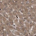 PSMB1 Antibody in Immunohistochemistry (IHC)