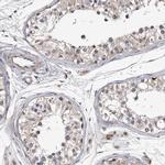 RCL Antibody in Immunohistochemistry (IHC)