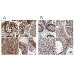 RAD23B Antibody in Immunohistochemistry (IHC)