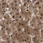 RAD23B Antibody in Immunohistochemistry (IHC)