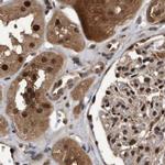 RAD23B Antibody in Immunohistochemistry (IHC)