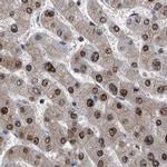 RAD23B Antibody in Immunohistochemistry (IHC)