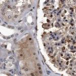 RAD23B Antibody in Immunohistochemistry (IHC)