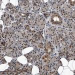 RAD23B Antibody in Immunohistochemistry (IHC)