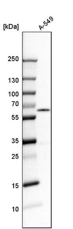 RAD23B Antibody in Western Blot (WB)