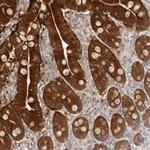 BCL2L15 Antibody in Immunohistochemistry (IHC)