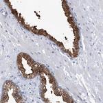 PGM3 Antibody in Immunohistochemistry (IHC)