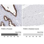 PGM3 Antibody