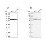 PGM3 Antibody in Western Blot (WB)