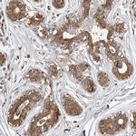 DARS Antibody in Immunohistochemistry (IHC)