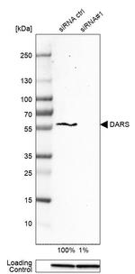 DARS Antibody in Western Blot (WB)