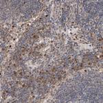 GADD45B Antibody in Immunohistochemistry (IHC)