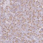 KIAA1324 Antibody in Immunohistochemistry (IHC)