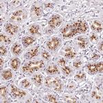 KIAA1324 Antibody in Immunohistochemistry (IHC)