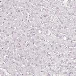 KIAA1324 Antibody in Immunohistochemistry (IHC)