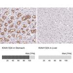 KIAA1324 Antibody