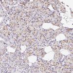 KIAA1324 Antibody in Immunohistochemistry (IHC)