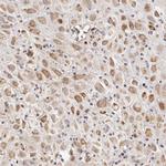 SCUBE2 Antibody in Immunohistochemistry (IHC)