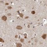 eIF3i Antibody in Immunohistochemistry (IHC)