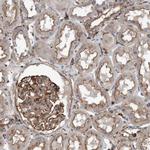 RSPO3 Antibody in Immunohistochemistry (IHC)