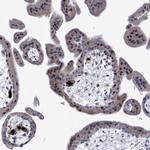 NUFIP1 Antibody in Immunohistochemistry (IHC)