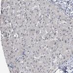 FTSJD2 Antibody in Immunohistochemistry (IHC)