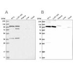 FTSJD2 Antibody in Western Blot (WB)