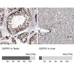 FTSJD2 Antibody in Immunohistochemistry (IHC)