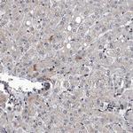 FTSJD2 Antibody in Immunohistochemistry (IHC)