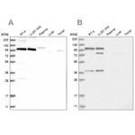 FTSJD2 Antibody in Western Blot (WB)