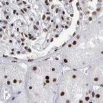 SF3A1 Antibody in Immunohistochemistry (IHC)