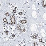 SF3A1 Antibody in Immunohistochemistry (IHC)