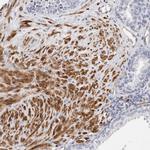 LMOD1 Antibody in Immunohistochemistry (IHC)