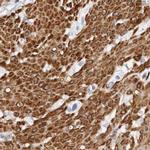 LMOD1 Antibody in Immunohistochemistry (IHC)