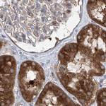 KLC4 Antibody in Immunohistochemistry (IHC)