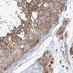 KLC4 Antibody in Immunohistochemistry (IHC)