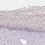 Hopx Antibody in Immunohistochemistry (IHC)