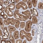 PDXK Antibody in Immunohistochemistry (IHC)